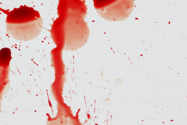 mo thay mau danh con gi