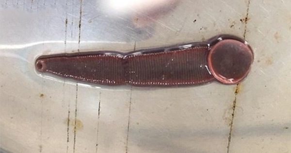 Nằm mơ thấy con đỉa